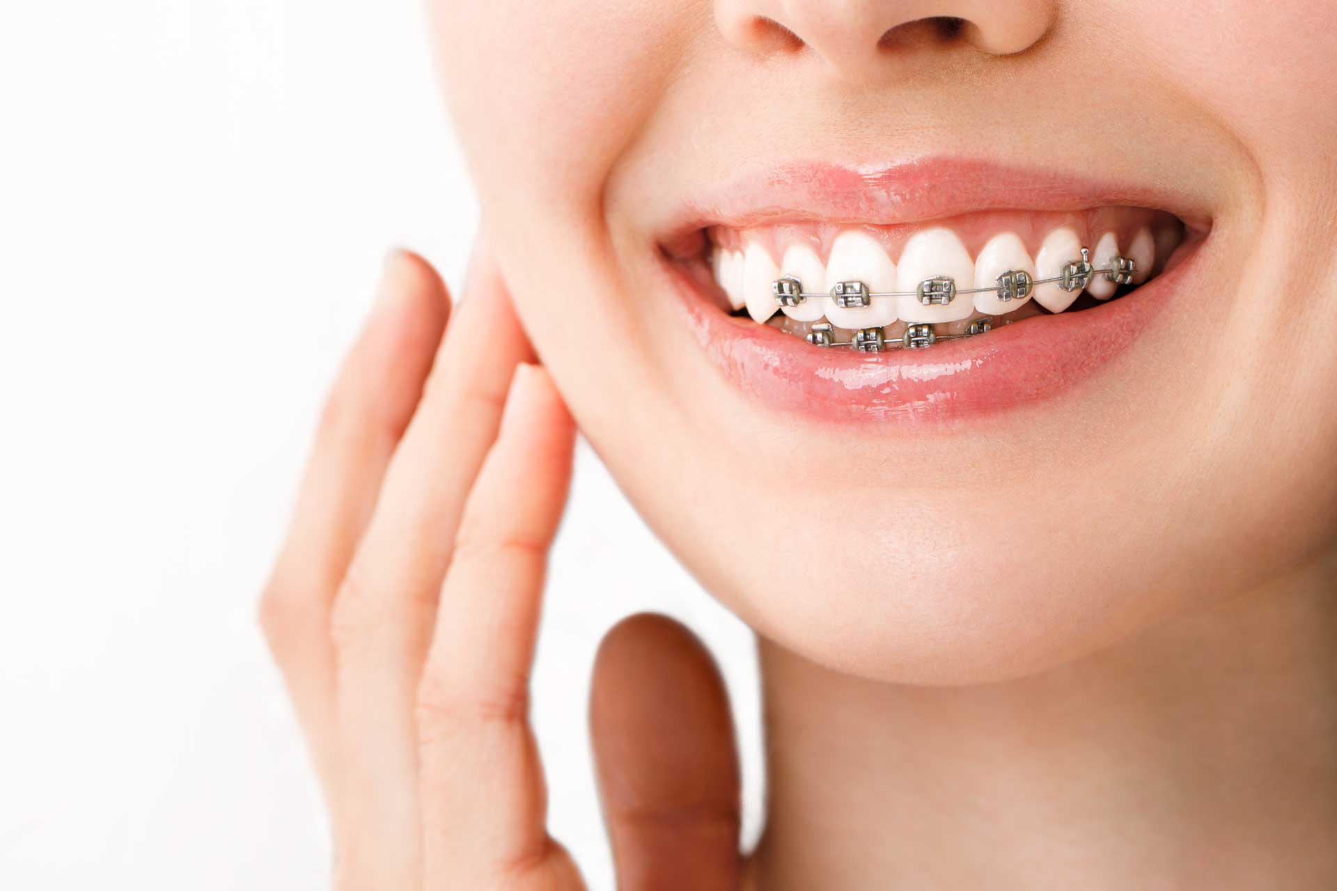 baident-ortodoncia baident-ortodoncia