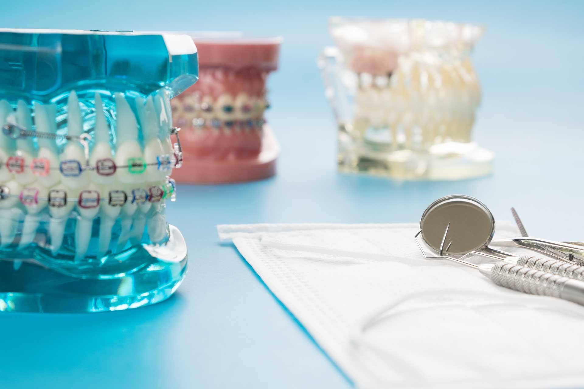 baident tratamiento ORTODONCIA